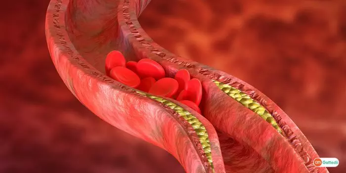 8 Amazing Ways How to improve blood circulation 1024x512 1