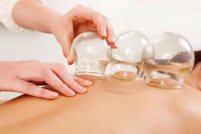 cupping massage therapy featured