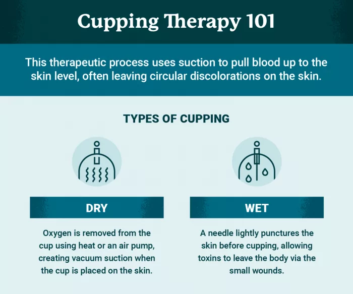 cupping therapy 101 1 1536x1281 1