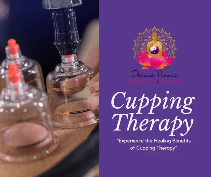 cupping therapy 20230201 0116